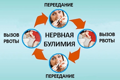 Лечение булимии в Лазаревском